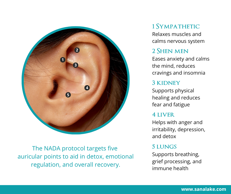 Diagram of an ear showing the five AcuDetox points used in the NADA protocol: Shen Men, Sympathetic Point, Kidney, Liver, and Lung. Each point is labeled and visually mapped to the outer ear.